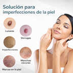 Lápiz antiacné con luz azul para tratar imperfecciones de forma precisa