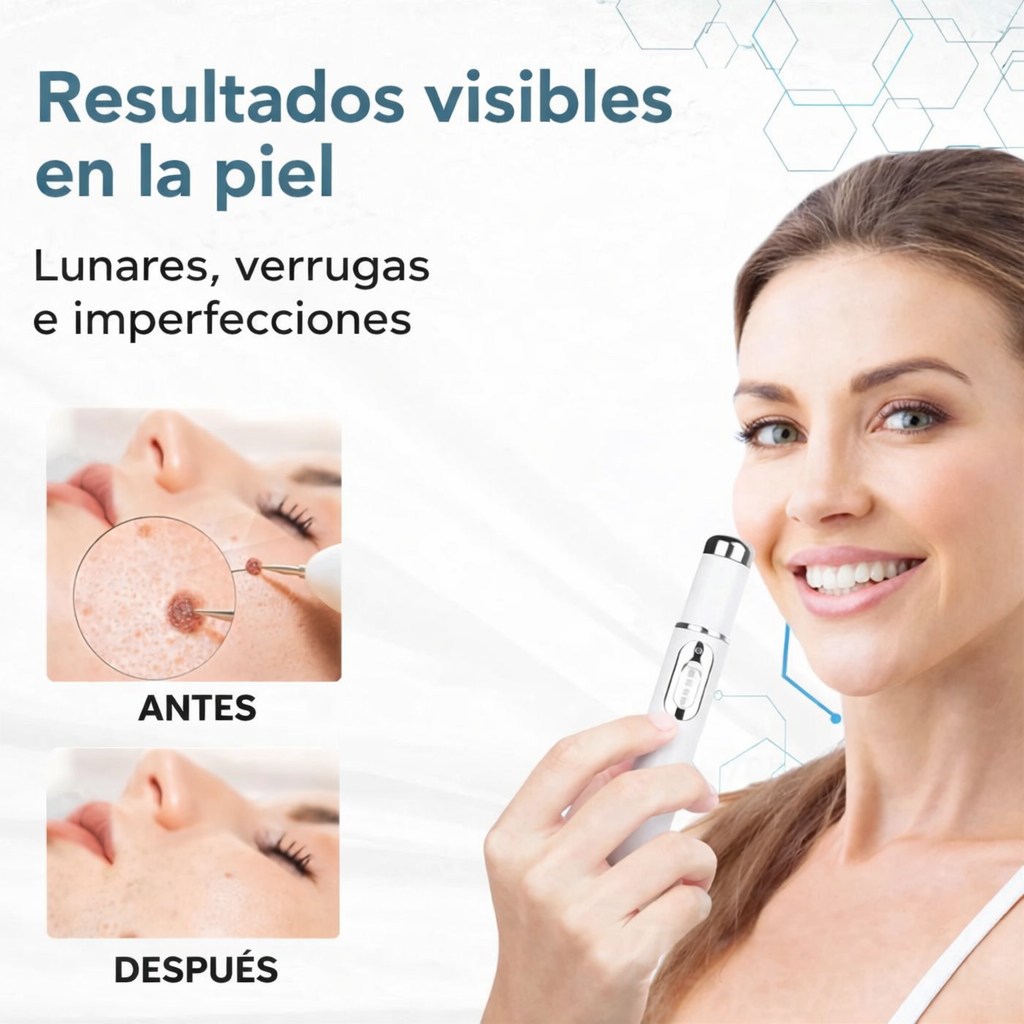 Lápiz antiacné con luz azul para tratar imperfecciones de forma precisa