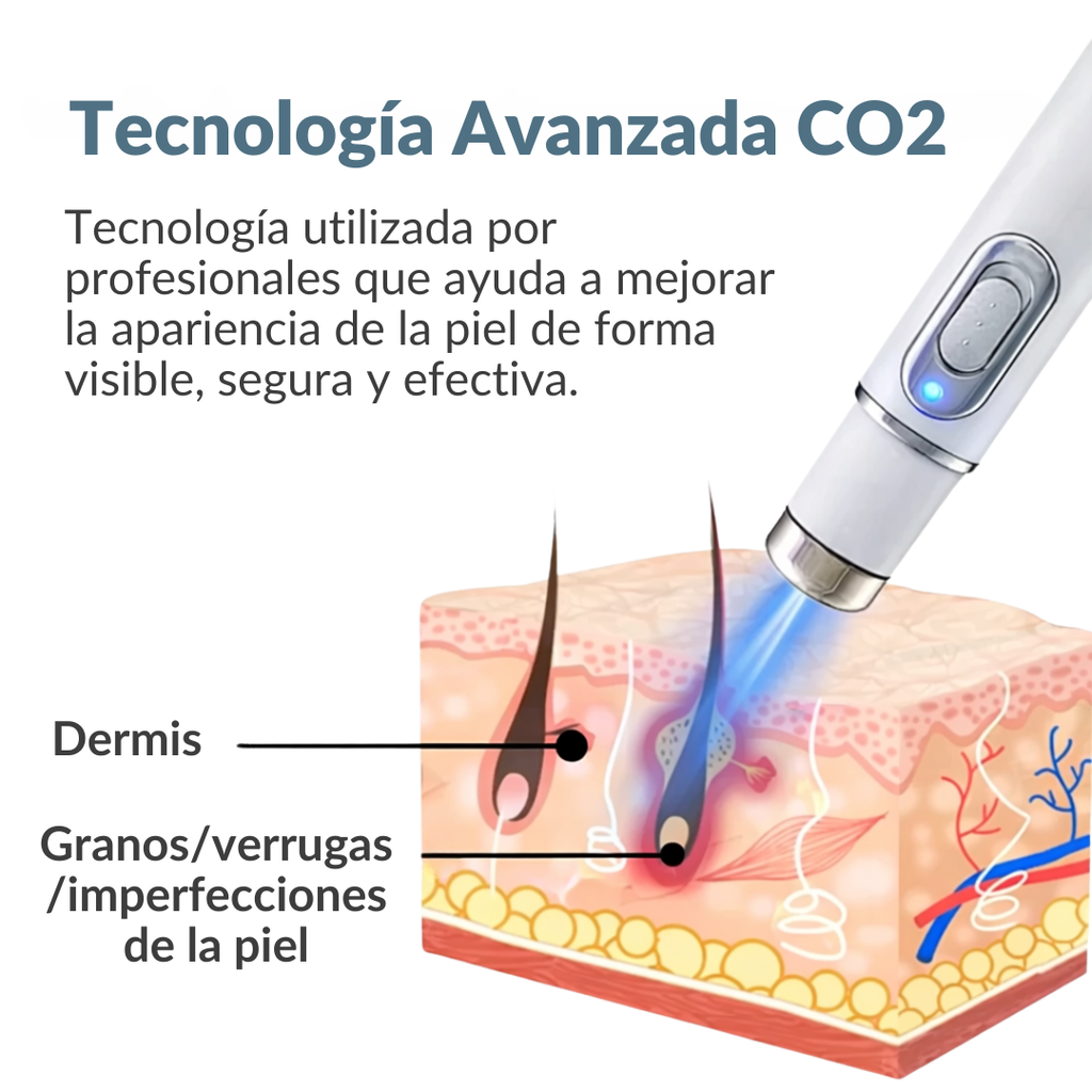 Lápiz antiacné con luz azul para tratar imperfecciones de forma precisa