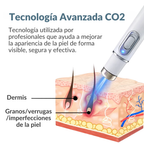 Lápiz antiacné con luz azul para tratar imperfecciones de forma precisa